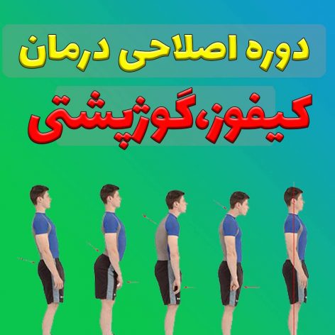 درمان کیفوز گوژپشتی